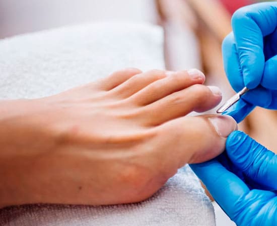 Cirurgia de unha